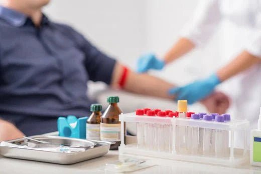 Blood Tests for Diagnosing Rheumatoid Arthritis: Key Tests and CBD Benefits