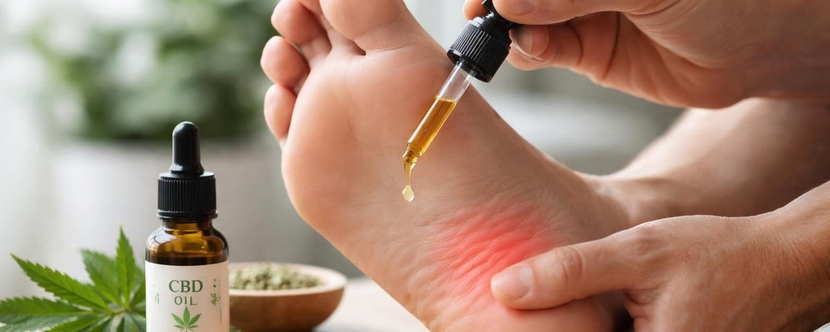 CBD for Plantar Fasciitis: Relief for Heel Pain