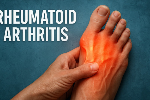 Rheumatoid Arthritis and Foot Pain Guide: Expert Insights 2026