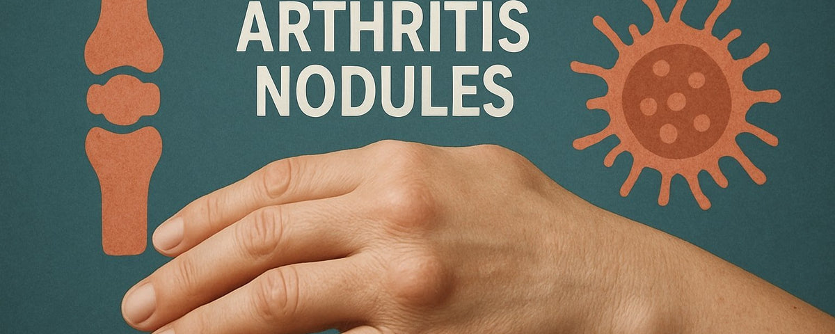 Rheumatoid Arthritis Nodules Guide: Symptoms, Care, and Insights 2026
